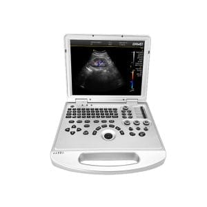 Point of Care Portable Color Ultrasound Scanner